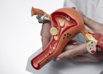 Полипэктомия